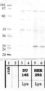 Anti-ST14 Rabbit Polyclonal Antibody