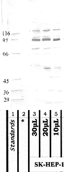 Anti-MASP1 Rabbit Polyclonal Antibody