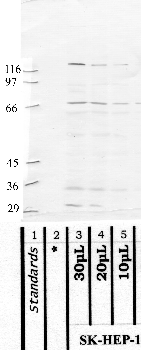 Anti-MASP1 Rabbit Polyclonal Antibody