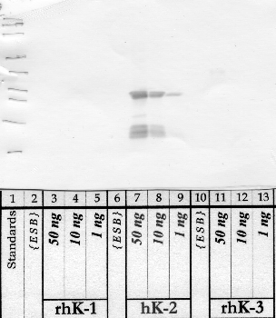 Anti-KLK2 Rabbit Polyclonal Antibody