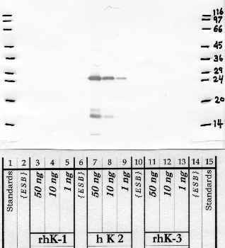 Anti-KLK2 Rabbit Polyclonal Antibody