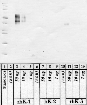 Anti-KLK1 Rabbit Polyclonal Antibody