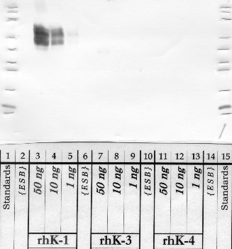 Anti-KLK1 Rabbit Polyclonal Antibody