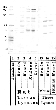 Anti-HTRA3 Rabbit Polyclonal Antibody