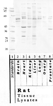 Anti-HTRA3 Rabbit Polyclonal Antibody