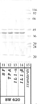 Anti-HTRA3 Rabbit Polyclonal Antibody