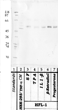 Anti-HTRA1 Rabbit Polyclonal Antibody