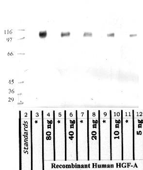 Anti-HGFAC Rabbit Polyclonal Antibody