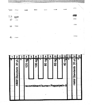Anti-PAPPA2 Rabbit Polyclonal Antibody