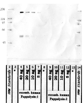 Anti-PAPPA Rabbit Polyclonal Antibody