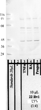 Anti-MMEL1 Rabbit Polyclonal Antibody