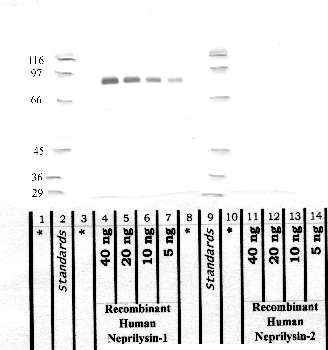 Anti-MME Rabbit Polyclonal Antibody