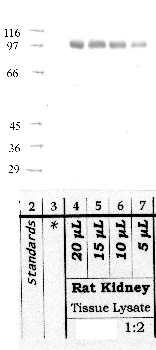 Anti-MME Rabbit Polyclonal Antibody