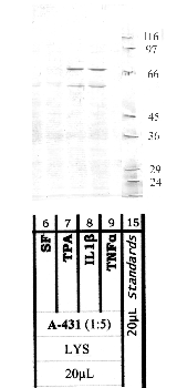 Anti-MMP16 Rabbit Polyclonal Antibody