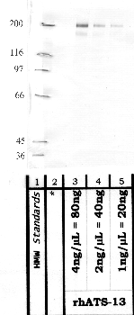Anti-ADAMTS13 Rabbit Polyclonal Antibody