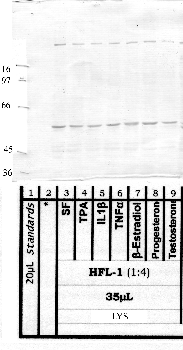 Anti-ADAMTS7 Rabbit Polyclonal Antibody