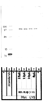 Anti-ADAMTS6 Rabbit Polyclonal Antibody