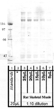 Anti-ADAMTS6 Rabbit Polyclonal Antibody