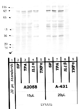 Anti-ADAMTS2 Rabbit Polyclonal Antibody