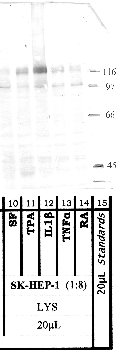 Anti-ADAMTS1 Rabbit Polyclonal Antibody