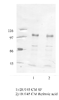Anti-ADAM22 Rabbit Polyclonal Antibody