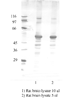Anti-ADAM22 Rabbit Polyclonal Antibody