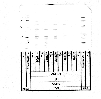 Anti-ADAM13 Rabbit Polyclonal Antibody