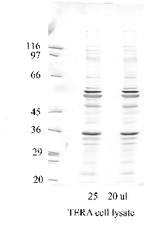 Anti-ADAM11 Rabbit Polyclonal Antibody