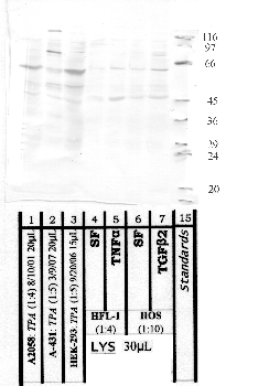 Anti-ADAM10 Rabbit Polyclonal Antibody