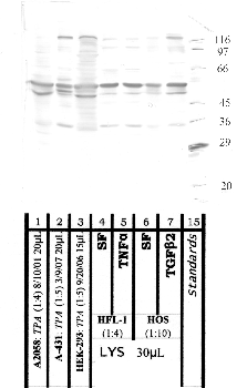 Anti-ADAM10 Rabbit Polyclonal Antibody