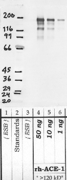 Anti-ACE Rabbit Polyclonal Antibody