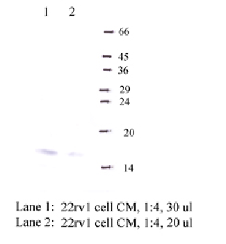 Anti-CSTM Rabbit Polyclonal Antibody