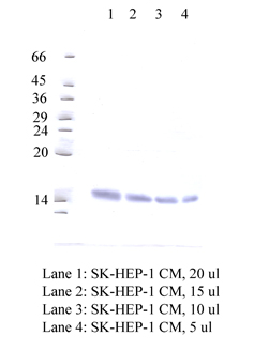 Anti-CSTC Rabbit Polyclonal Antibody
