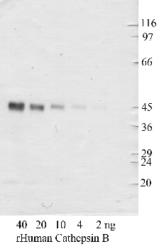 Anti-CTSB Rabbit Polyclonal Antibody