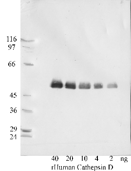 Anti-CTSD Rabbit Polyclonal Antibody