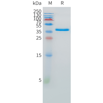 Mouse CD38 Protein, His Tag