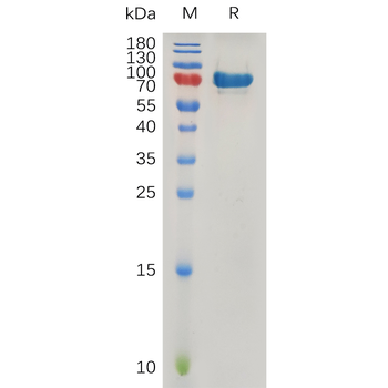 Human HGF Protein, hFc Tag