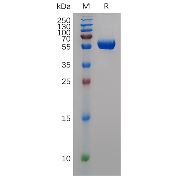 Human CD6 Protein, His Tag