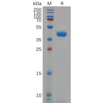 Human NCR1 Protein, hFc Tag