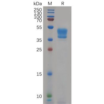 Human NKG2A Protein, hFc Tag