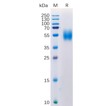 Human RSPO3 (22-146) Protein, hFc Tag