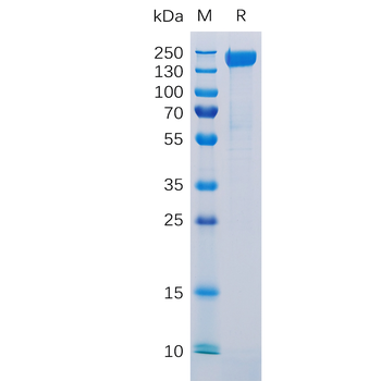 Human FOLR2 Protein, His Tag