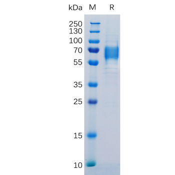 Human TNFRSF25 Protein, hFc Tag