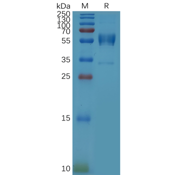 Human TSLP Protein, hFc Tag