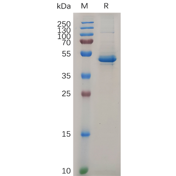Human TREM2 Protein, hFc Tag