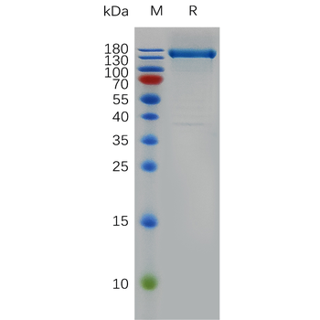 Human CDCP1 Protein, His Tag