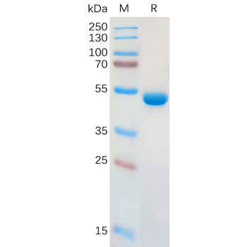 Human PCSK9 Protein, hFc Tag