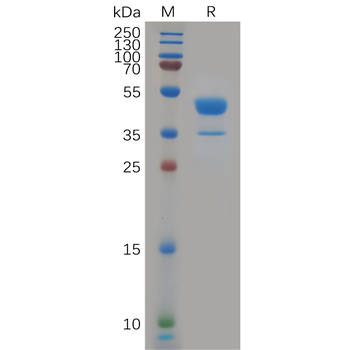 Human IL21 Protein, mFc Tag