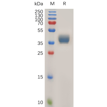 Human PSMA Protein, mFc Tag