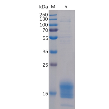 Human DKK1 Protein, hFc Tag